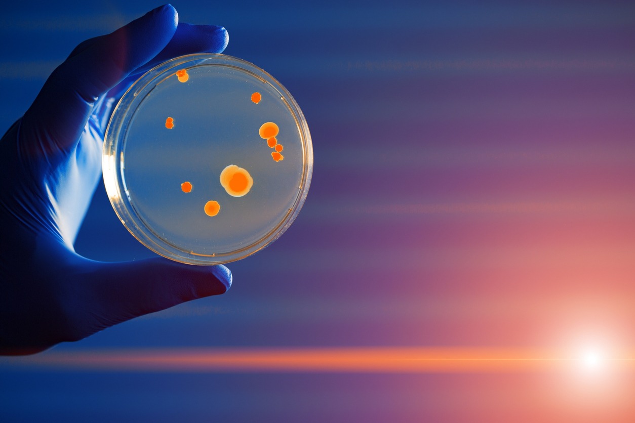 Petri dish in hand